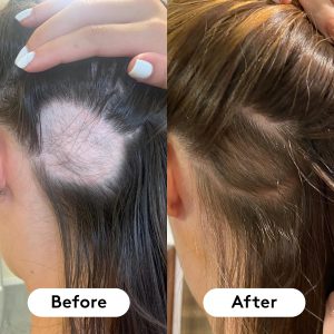 پاستیل تقویت کننده و ضد ریزش مو هیربرست HAIR BURST Chewable  Hair Vitamin