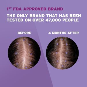 تقویت کننده رشد موی زنانه روگین ماینوکسیدیل Rogaine